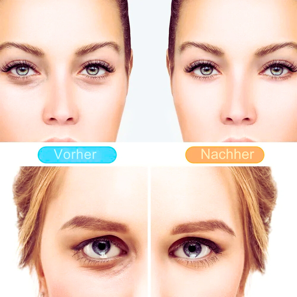 EyeRefresh - Wellness für deine Augen